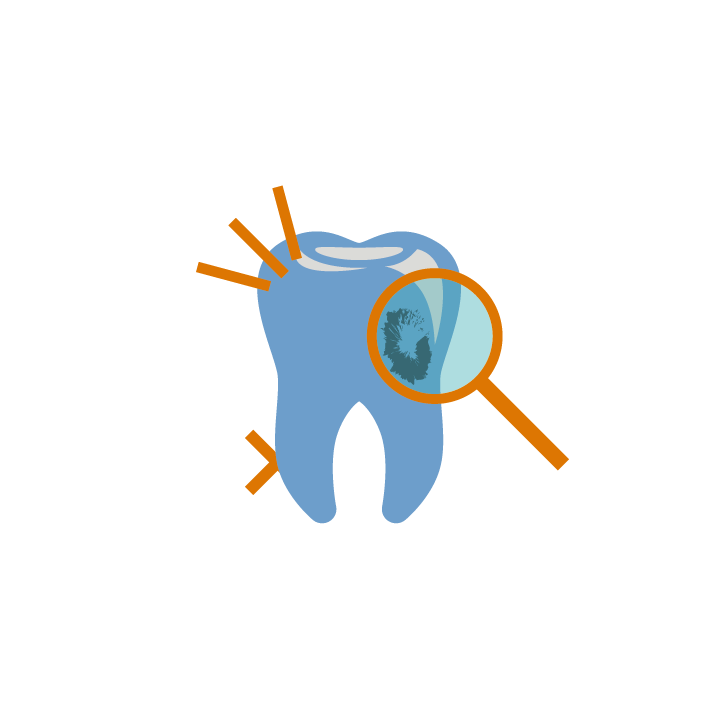 conservativa endodonzia