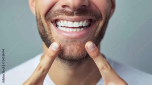 Faccette Dentali